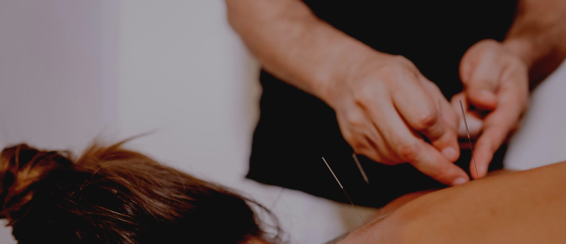 Paciente sendo tratada com Acupuntura